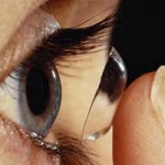 Коррекция зрения дневными контактными линзами - услуги