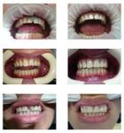 Стоматология: Художественная реставрация фронтальной группы зубов