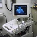 Ультразвуковая диагностика (УЗИ/УЗС) гинекологическое, включая определение ранних сроков беременности (до 12 недель) - услуги